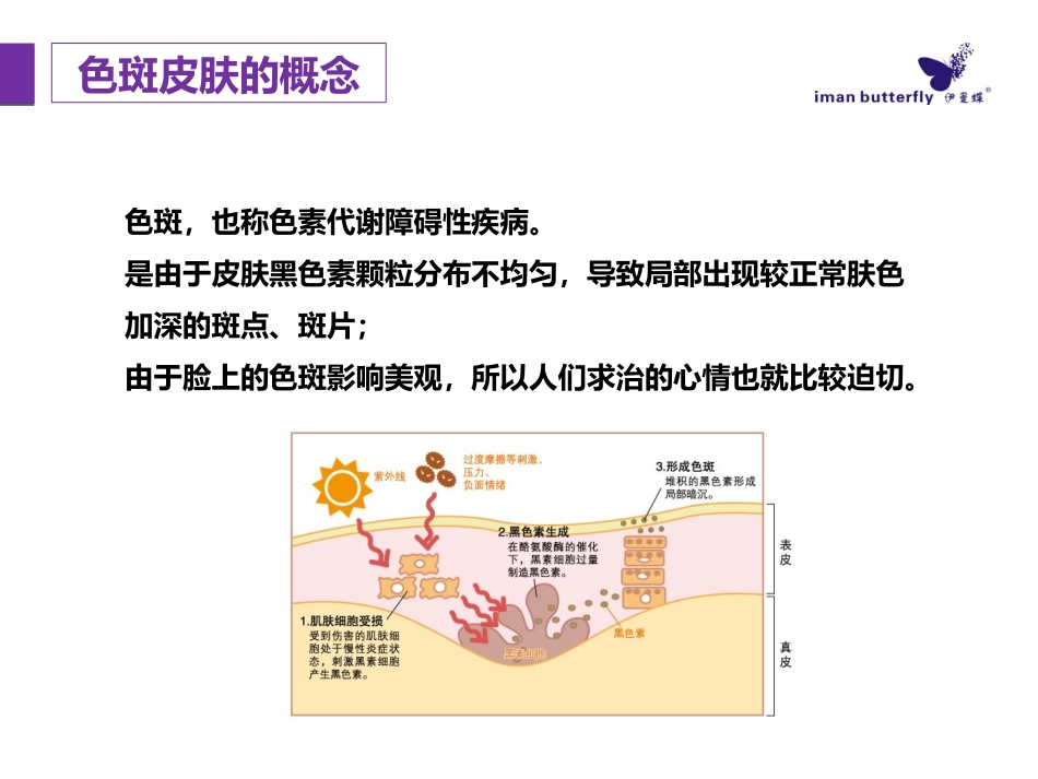 色斑皮肤的形成和护理_第2页