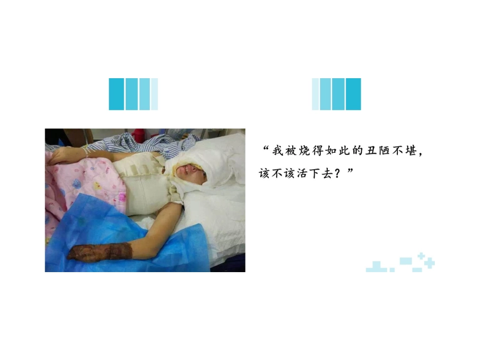 烧伤病人麻醉病例_第2页