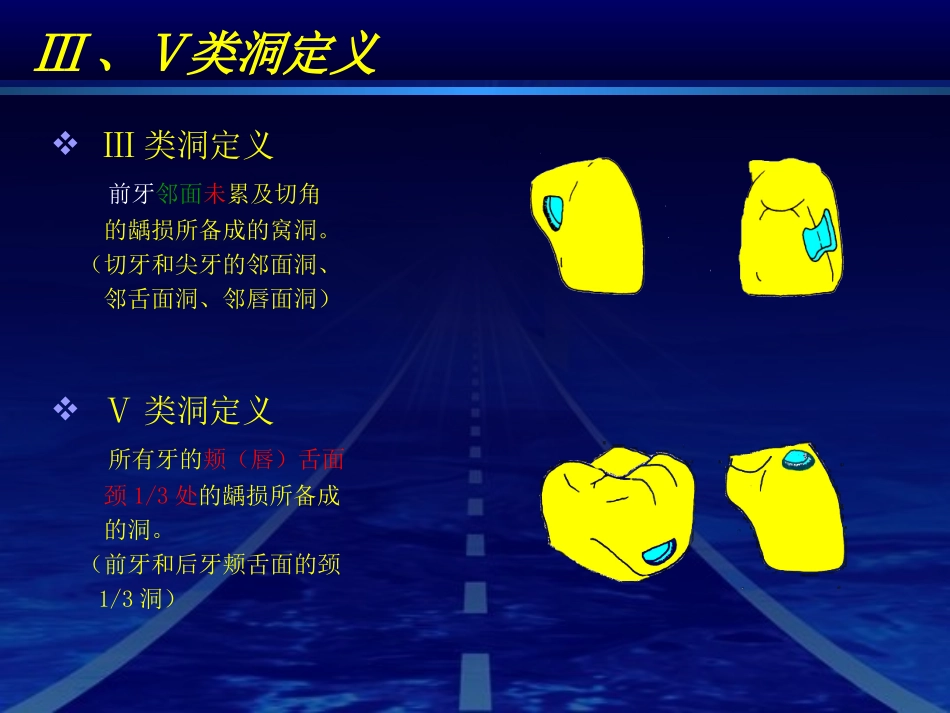 实验四石膏牙离体牙Ⅲ_第2页