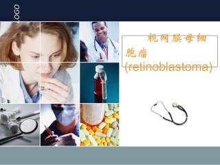 视网膜母细胞瘤