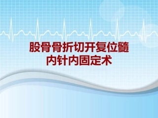 手术讲解模板股骨骨折切开复位髓内针内固定术
