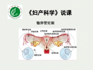 输卵管妊娠说课