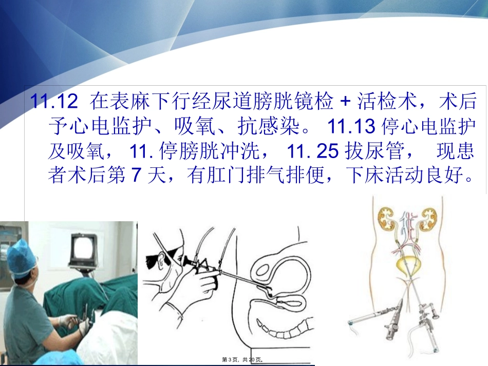 输尿管癌的护理查房_第3页
