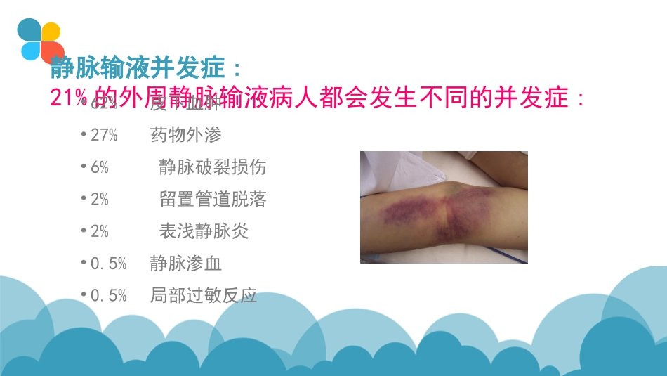 输液性静脉炎_第2页