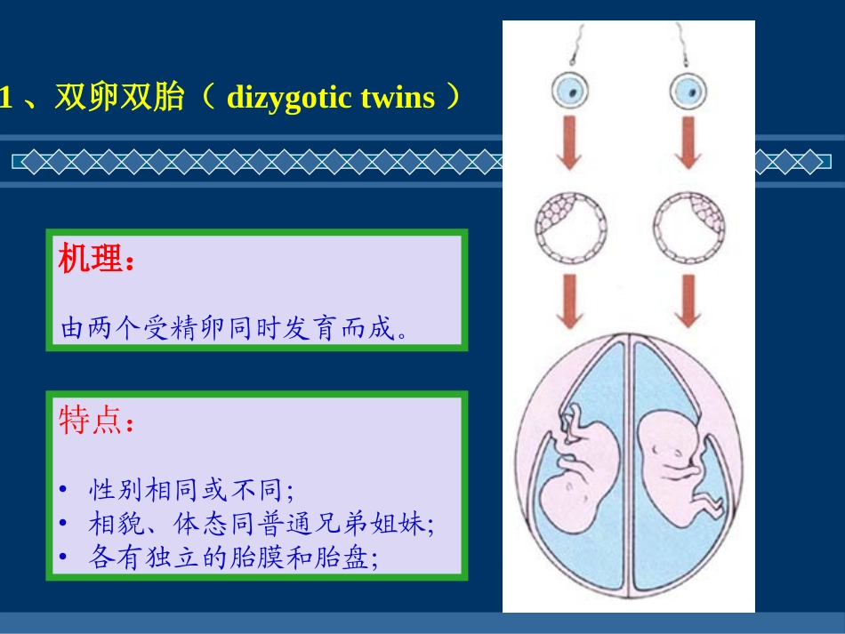 双胎多胎和联胎_第3页