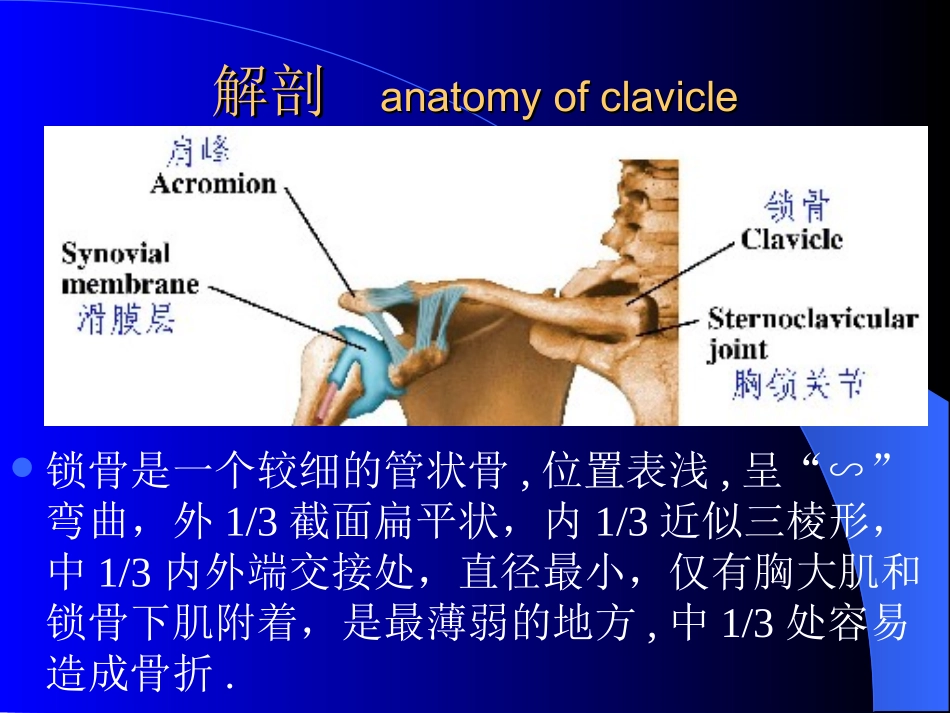 锁骨骨折诊疗和治疗图文_第2页