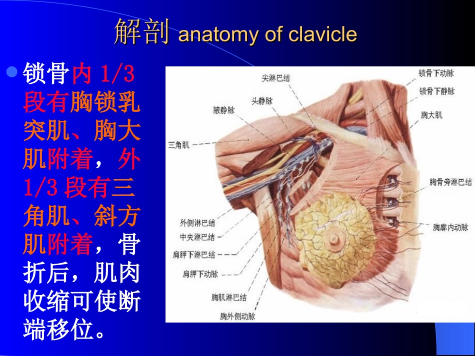 锁骨骨折诊疗和治疗图文_第3页