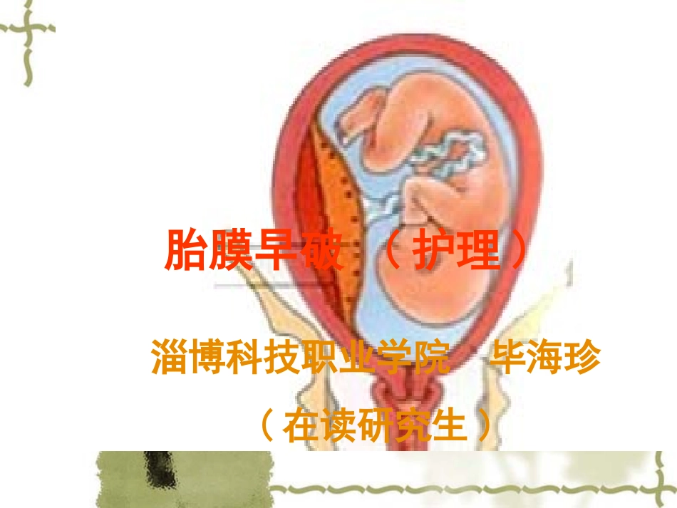胎膜早破护理_第1页