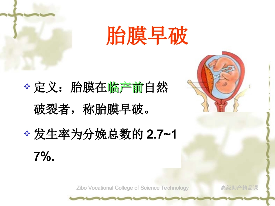 胎膜早破护理_第2页