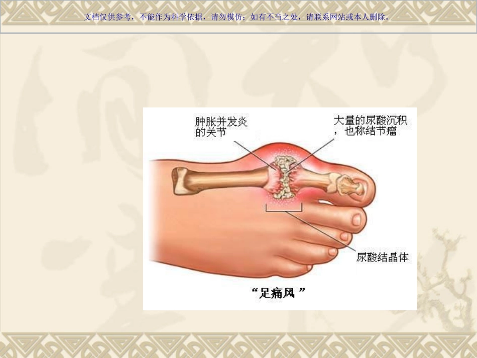 痛风病人的健康教育课件_第3页