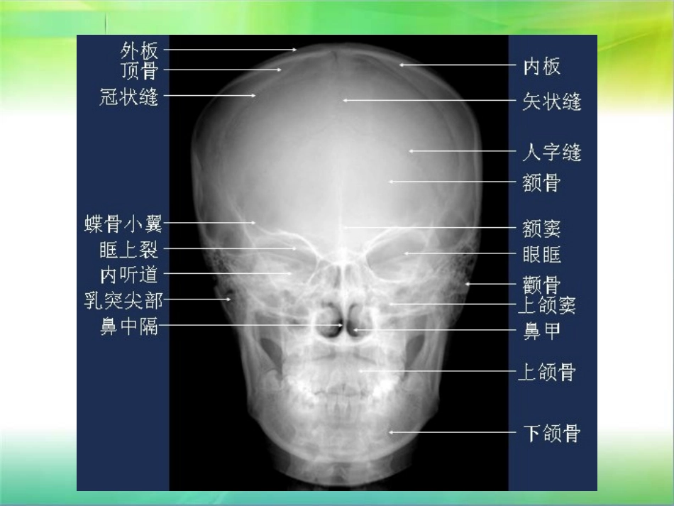 头颅五官投照和X线解剖讲义_第3页