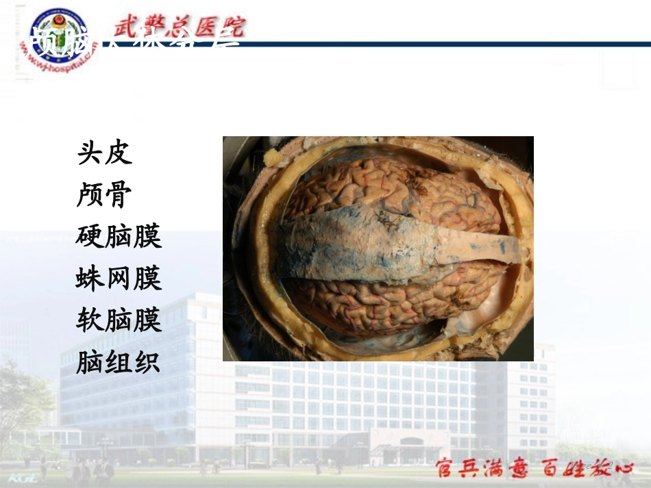头皮和颅骨解剖分解_第2页