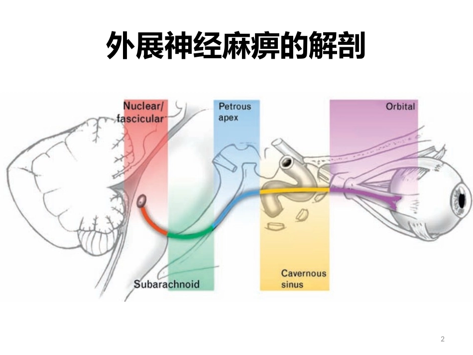 外展神经麻痹_第2页