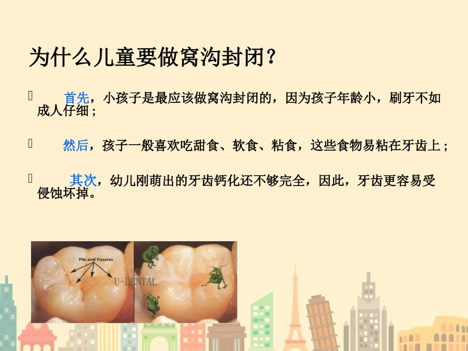 窝沟封闭的四手操作及护理_第3页