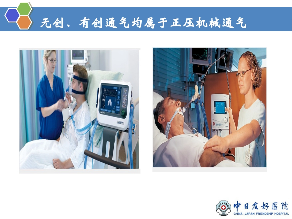 无创正压通气的模式和参数_第2页