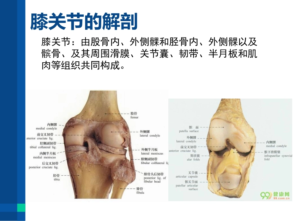 膝关节骨性关节炎的护理课件_第2页