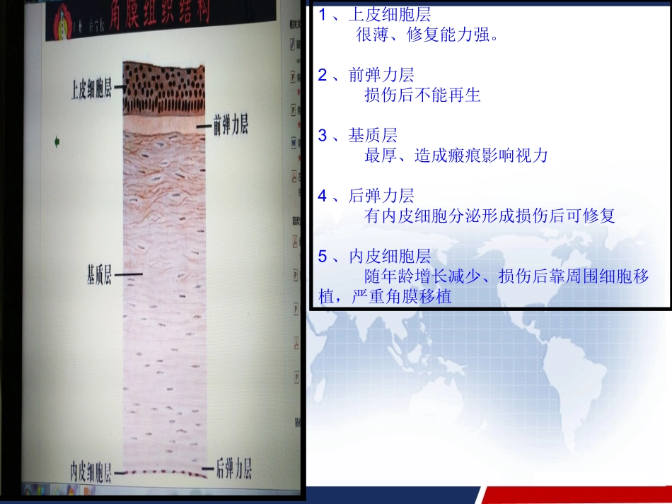 细菌性角膜溃疡眼科护理查房_第2页