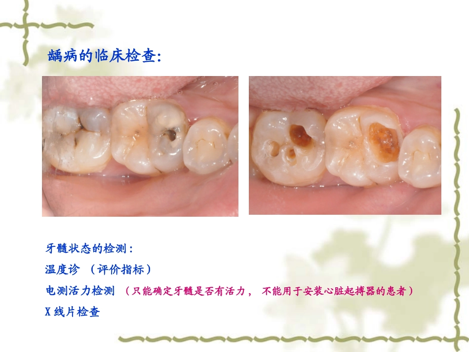 橡皮障下的三类洞预备课件_第3页