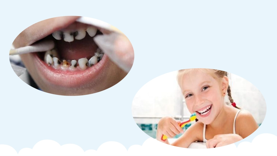 小学生牙齿健康_第3页