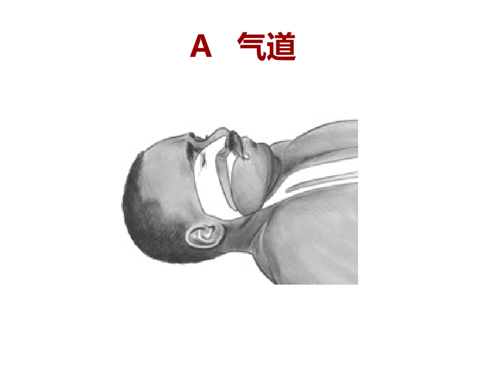 心肺复苏中的气道管理_第2页