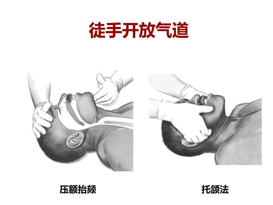 心肺复苏中的气道管理_第3页