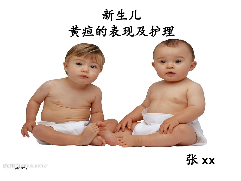 新生儿黄疸的表现及护理_第1页