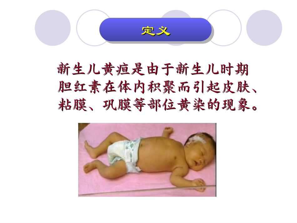 新生儿黄疸的表现及护理_第2页