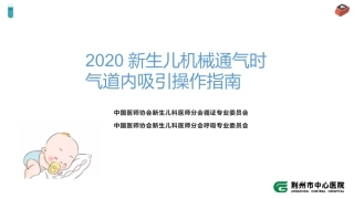 新生儿机械通气时气道内吸引操作指南