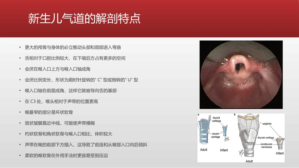 新生儿困难气道的管理_第3页
