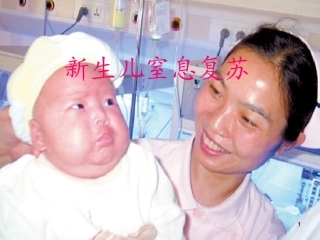 新生儿窒息复苏PPT讲义