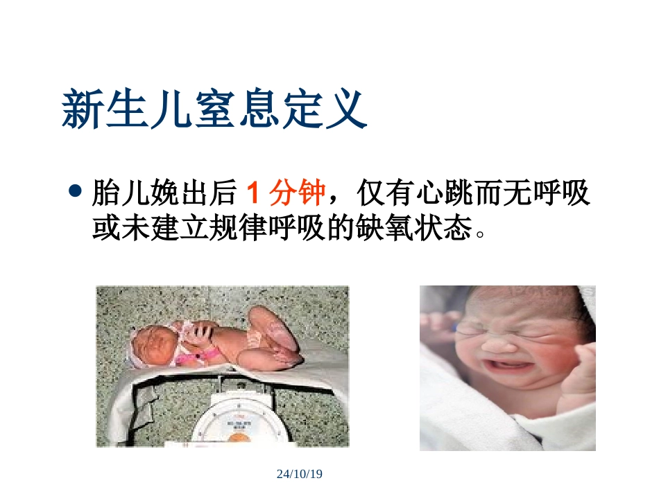 新生儿窒息护理课件_第3页