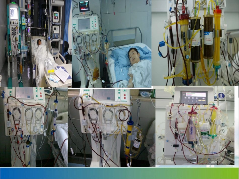 血浆置换操作流程课件_第1页