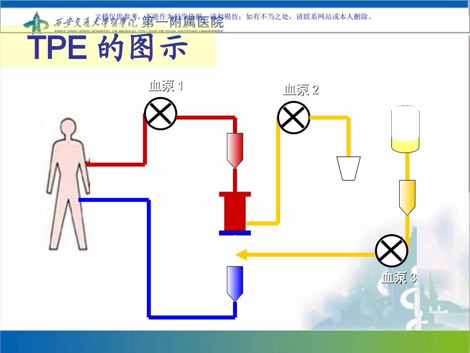 血浆置换操作流程课件_第3页