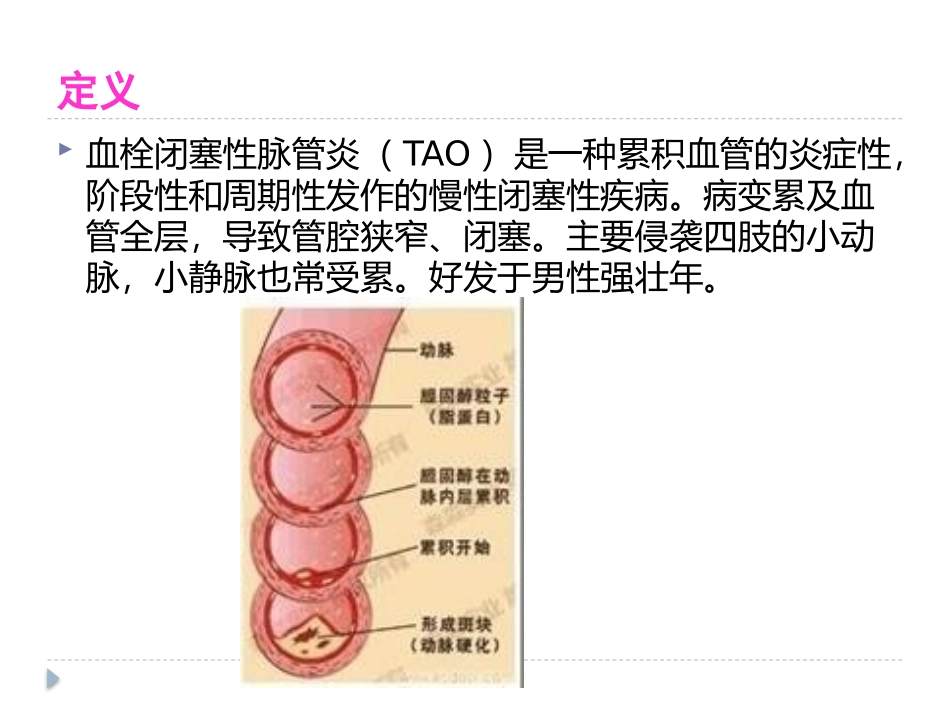 血栓闭塞性脉管炎护理_第2页