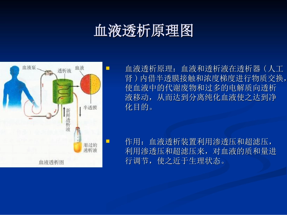 血液透析概述_第2页