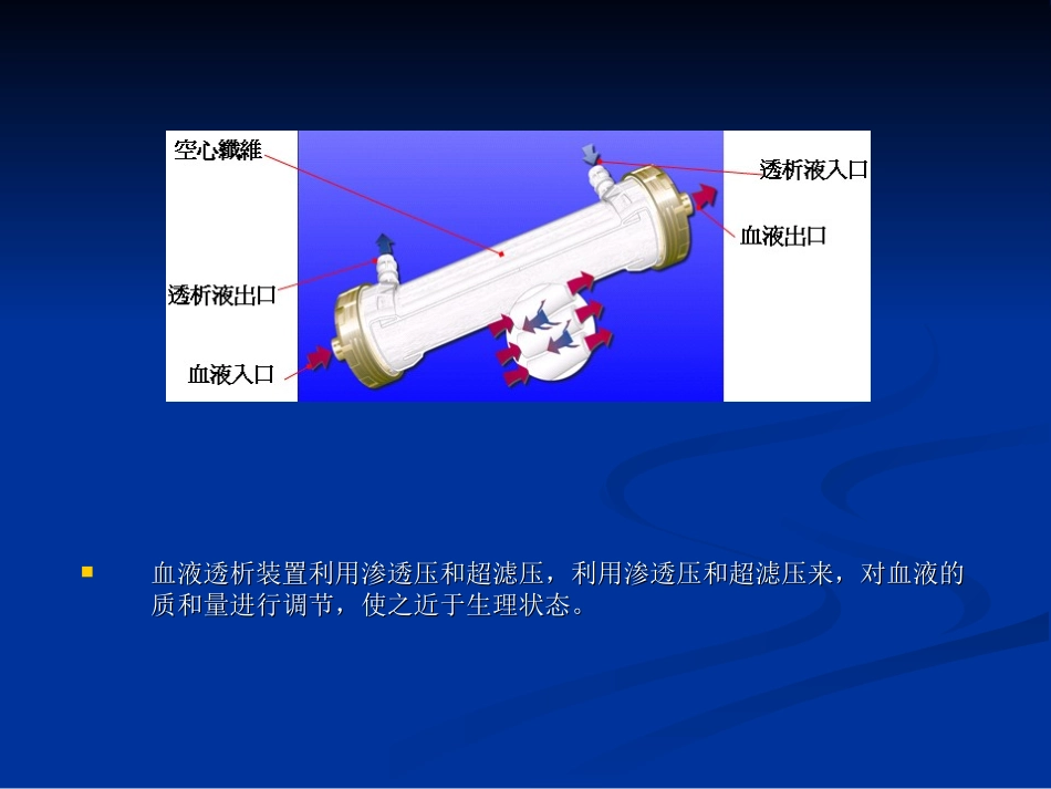 血液透析概述_第3页
