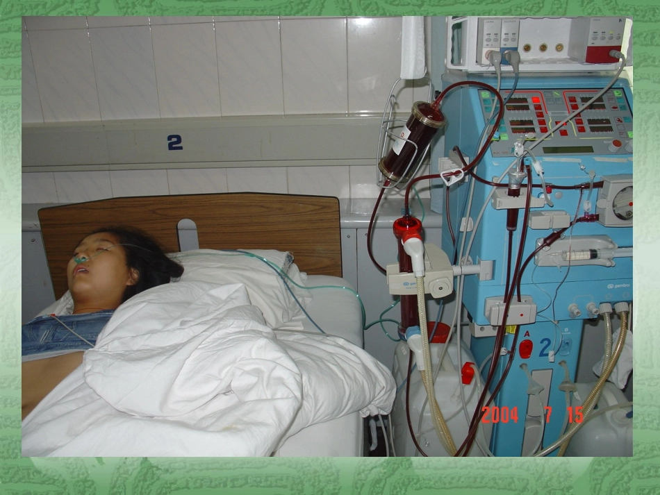 血液透析应急预案_第2页