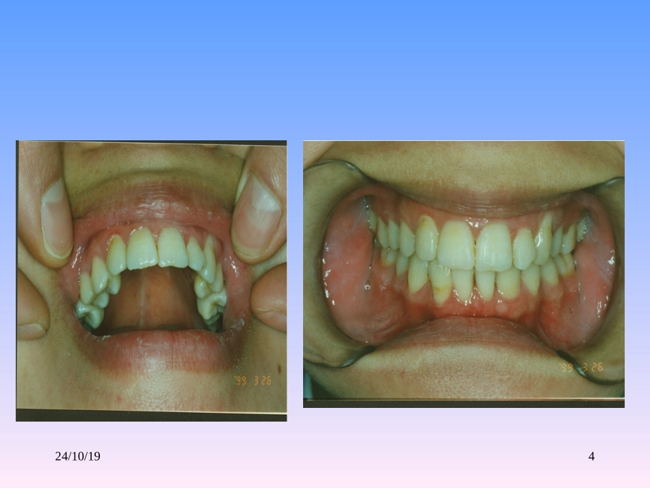 牙齿解剖课件_第2页