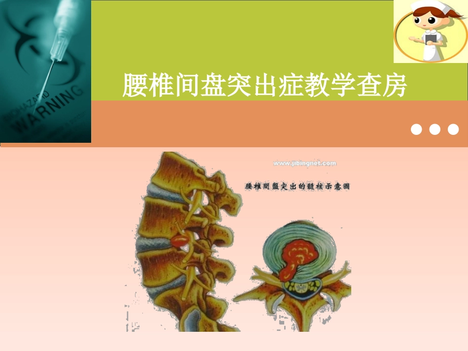 腰椎间盘突出症教学查房_第1页