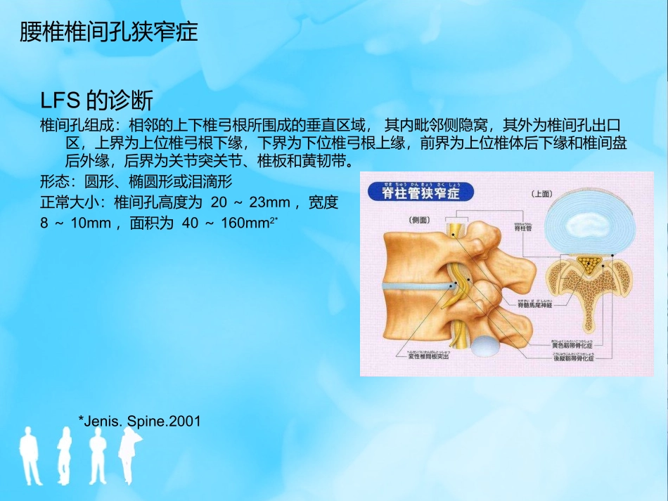 腰椎椎间孔狭窄症_第3页