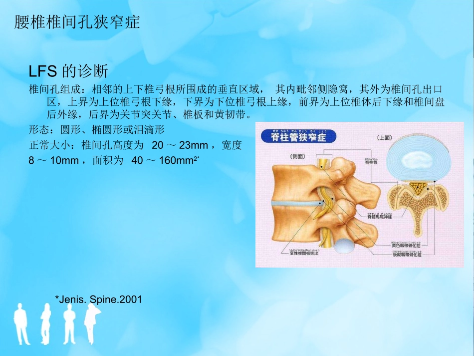 腰椎椎间孔狭窄症课件_第3页