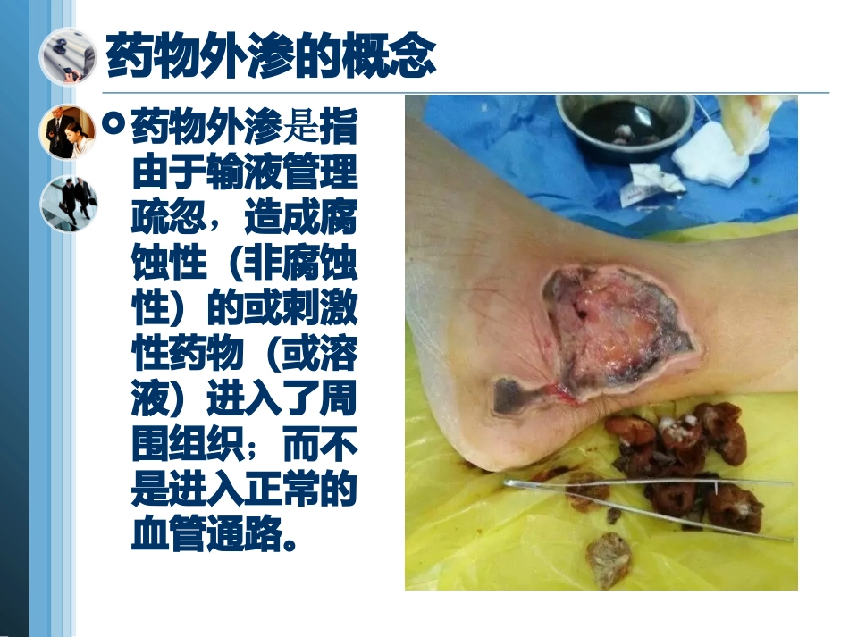 药物外渗的严重后果及处置要点_第3页