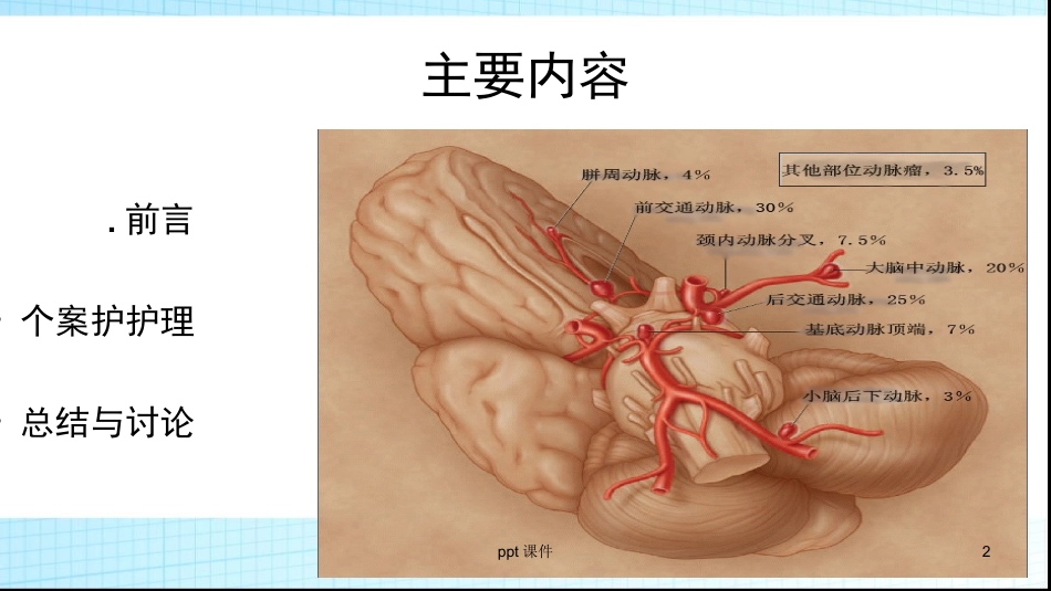 一例动脉瘤头痛的个案护理课件_第2页