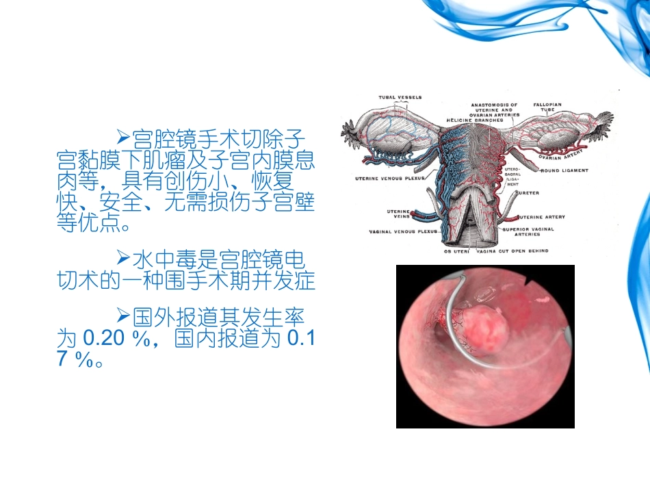 医学课件宫腔镜水中毒_第1页