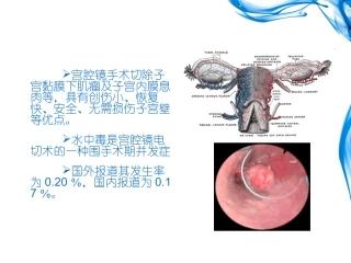 医学课件宫腔镜水中毒