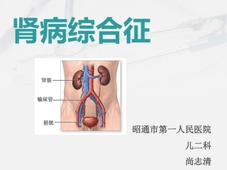 医学课件小儿肾病综合征