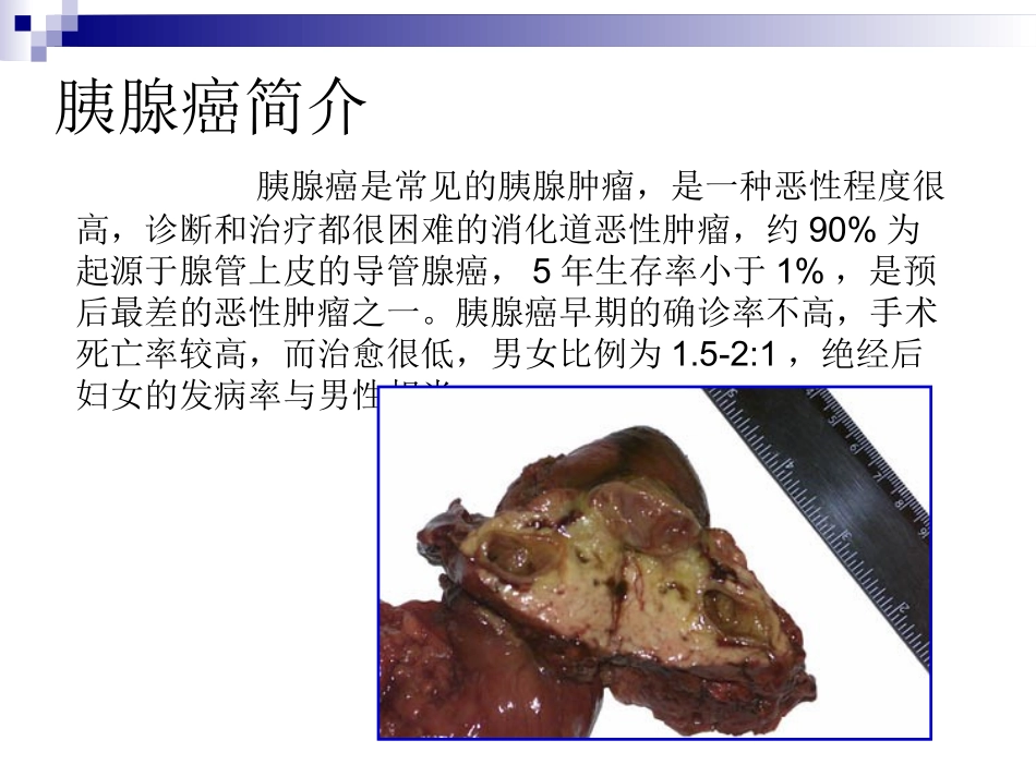胰腺癌围手术期护理_第3页