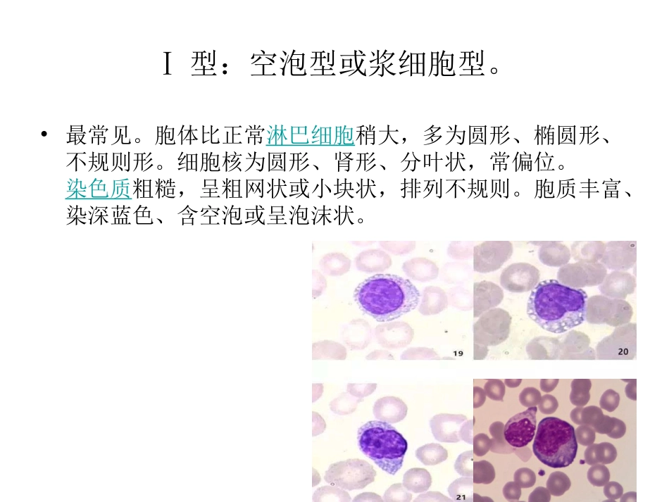 异常淋巴细胞形态_第3页