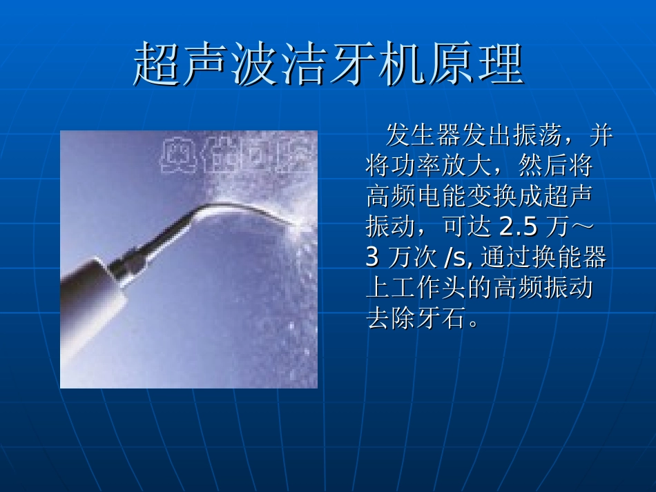 龈上洁治术超声_第3页