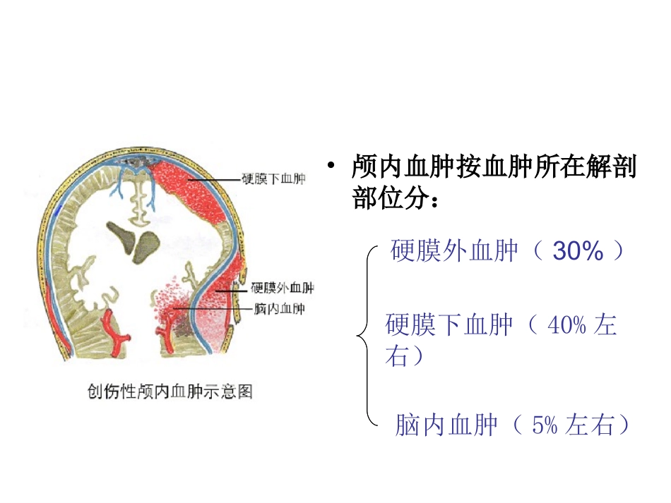 硬膜外血肿的护理_第3页